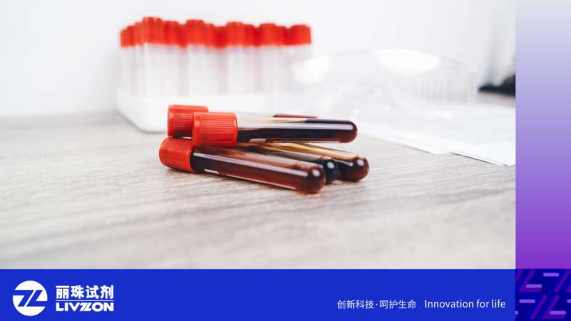HIV 病毒载量 “测不到”，HIV 药能停吗？