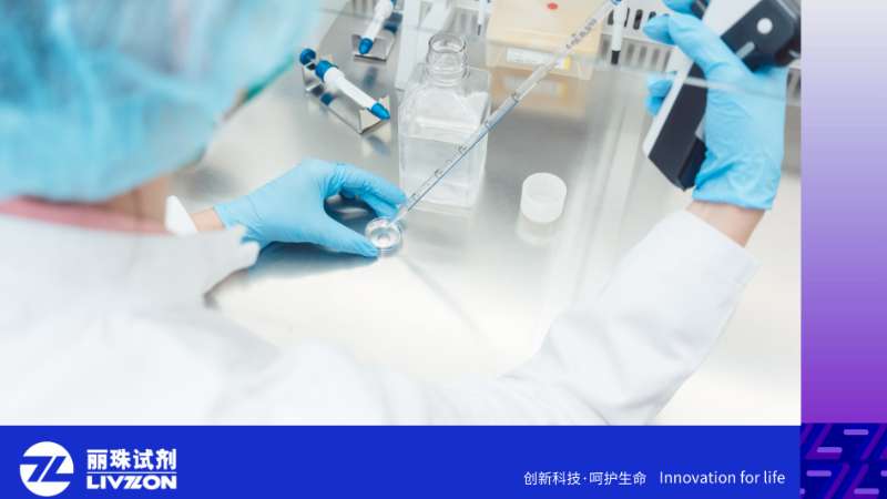 类风湿因子（RF）阳性≠类风湿关节炎！一文搞懂RF的检测意义