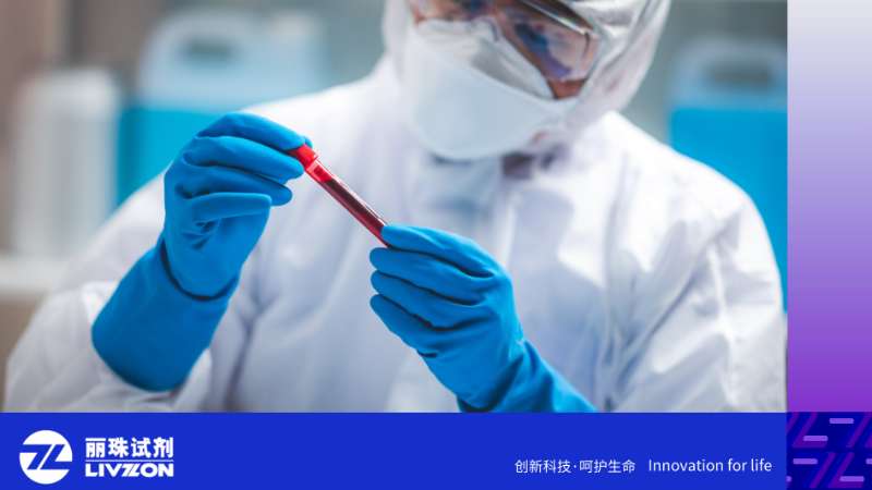 重磅更新！抗磷脂抗体临床应用中国专家指南（2026版）解读​